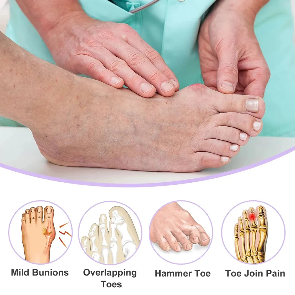 8PCS Silicone Toe Separators for Foot Care and Pain Relief